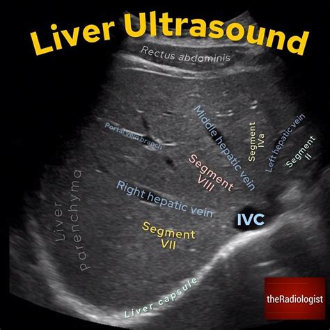 Liver Ultrasound Anatomy