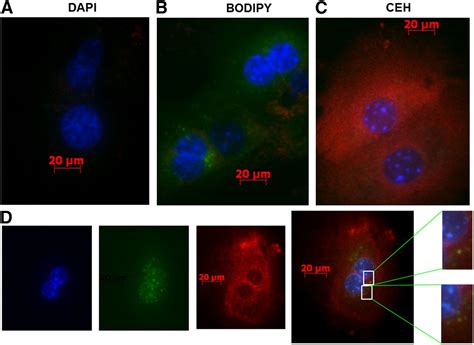 Cooperation Between Hepatic Cholesteryl Ester Hydrolase And Scavenger