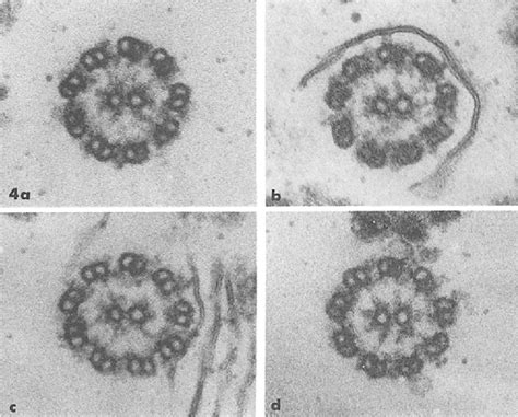 Figure From Cation Induced Attachment Of Ciliary Dynein Cross Bridges