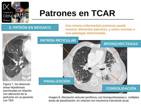 Pdf Clasificaci N De Los Patrones Radiol Gicos Pdf Fileobjetivos