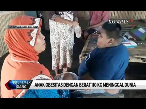 Anak Obesitas Dengan Berat 110kg Meninggal Dunia YouTube