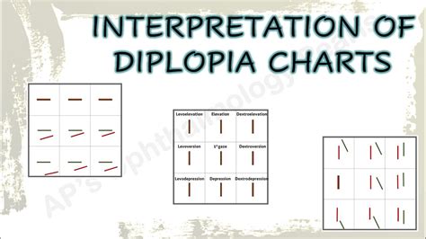 Interpretation Of Diplopia Charts Youtube