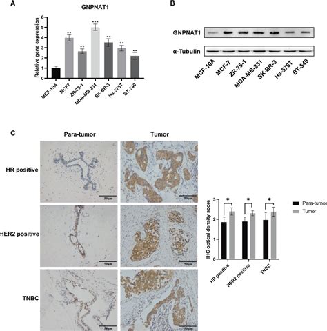 Frontiers Gnpnat Is A Potential Biomarker Correlated With Immune