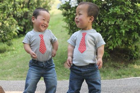 Hypochondroplasia Dwarfism