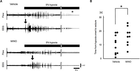 Inhibition Of Microglial Activation Delayed The Occurrence Of Seizures