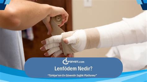 Lenf Dem Nedir Belirtileri Ve Tedavileri Fd Yet