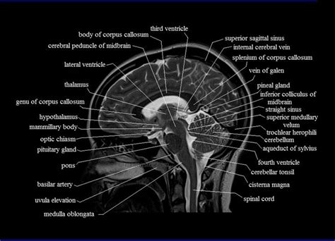 Pin By Lisa DeBarr On Medical Health Biology Mri Brain Mri Brain