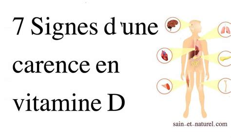 Signes Potentiels D Une Carence En Vitamine D