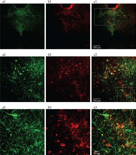 Selective Expression Of Chr2 On 5 Ht Neurons In The Dr Of Transgenic Download Scientific