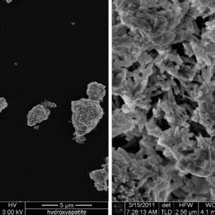 Scanning electron microscope (SEM) images of hydroxyapatite (HA ...