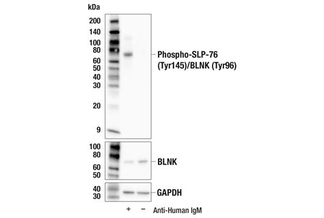 Phospho SLP 76 Tyr145 BLNK Tyr96 E9D6N Rabbit MAb Cell