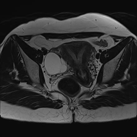 Radiology Quiz 93869 Radiopaedia Org