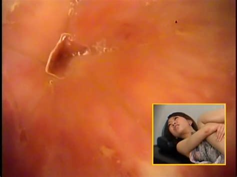 Japanese girl anal endoscope video 3 ThisVid 日本語で