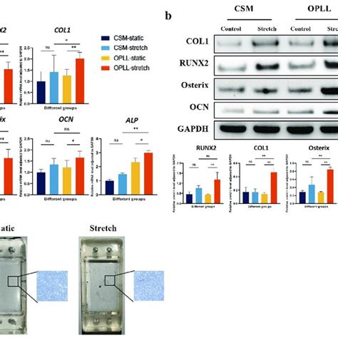 Stretch Stimulation Promotes Osteogenic Differentiation Of Opll Cells