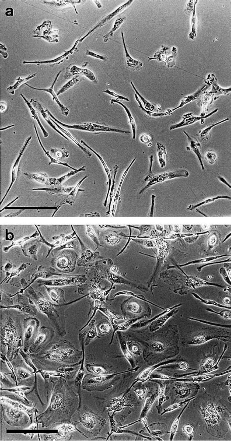 Phase Contrast Micrographs Of Primary Human Adult Microglial Cell