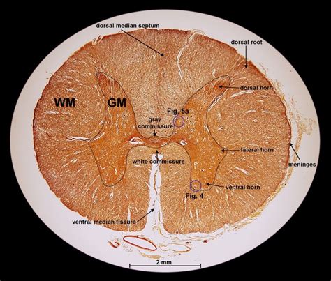 Spinal Cord Cross Section Removal Tool Spinal Cord Spinal