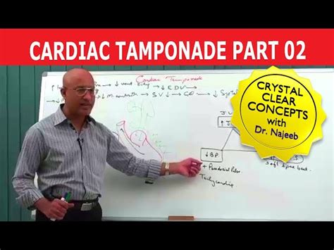 Free Video Cardiac Tamponade Cardiology Part 2 From Dr Najeeb