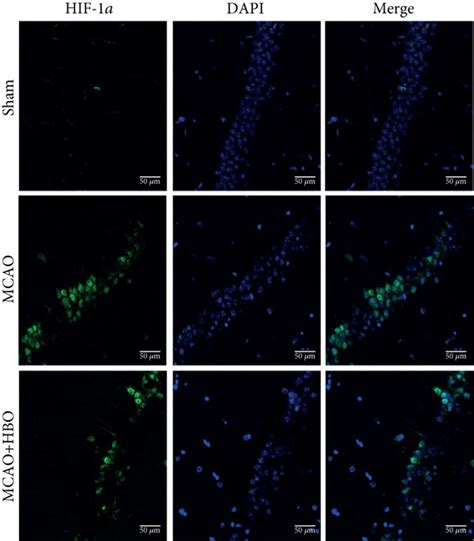 Hbo Suppressed The Expression Of Hif 1α In The Hippocampus Of Download Scientific Diagram