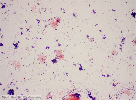 Gram stain demonstration slide, 400x 2 | Marc Perkins Photography