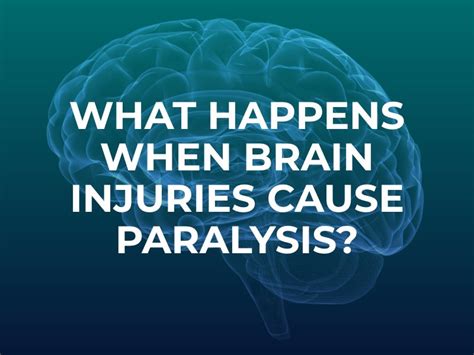 When Brain Injuries Cause Paralysis