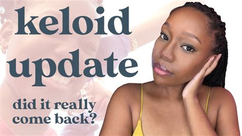 Keloid Update Before And After Photos How I Treated It With Surgery And Steroid Injections