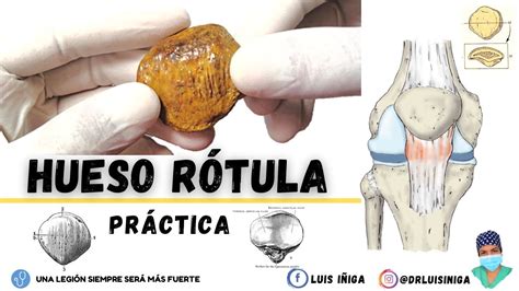 Anatomía Hueso Rótula Práctica Caras Bordes Base Vértice