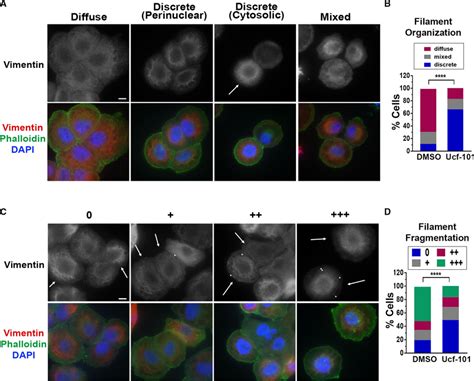 Inhibition Of HtrA2 Proteolytic Activity Reduces Vimentin Filament