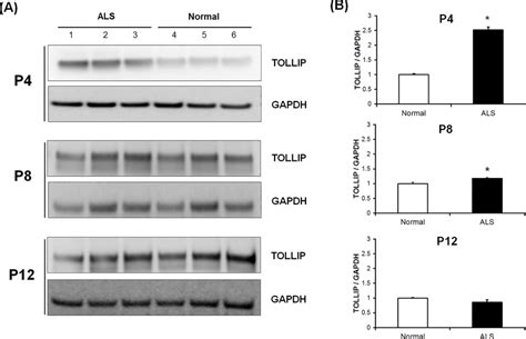 Validation Of Tollip Expression With Progression Of Passages By Western Download Scientific