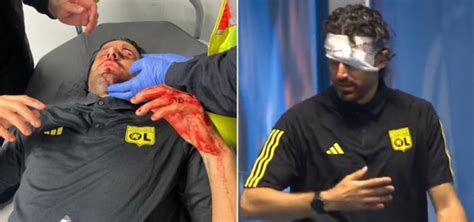 Fabio Grosso Come Sta L Allenatore Dopo L Agguato Dei Tifosi Del