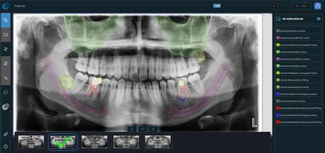 Diş hekimliğinde yapay zekalı tedavi ve eğitim çözümü Yapay Zeka ve