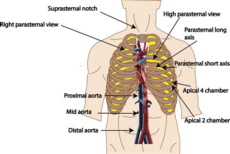 Discovering The Aorta Through Ultrasound Critical Care Sonography