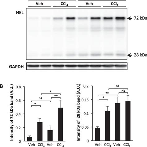 Ccl4 Induced Oxidative Stress In Bl6j And Bl6n Mice Bl6j And Bl6n Mice