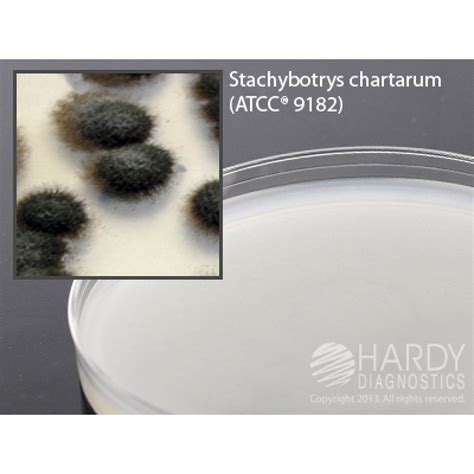 Hardy Diagnostic W83 Dry Culture Media Cellulose Agar Plate 90 Day