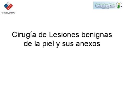 Ciruga De Lesiones Benignas De La Piel Y