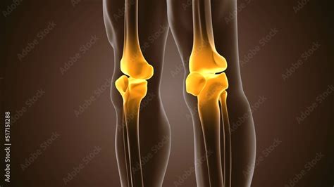 Medical concept of pain in the knee joint Stock Illustration | Adobe Stock