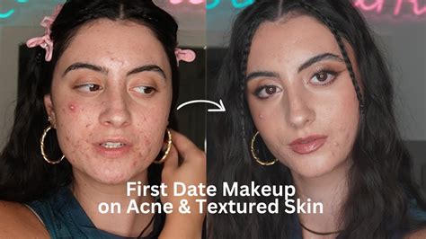 The Perfect Date Makeup Tutorial On Acne Textured Skin Youtube