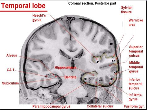 Anatomy of brain sulcus and gyrus - Dr.Sajith MD RD