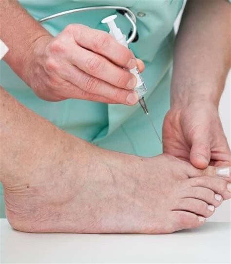 Cortisone Injections One Foot Clinic