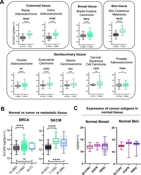 SLC3A2 gene expression is enhanced in different malignancies compared ...