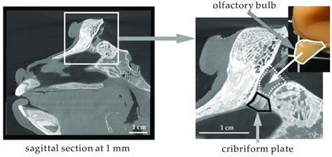 Location of the olfactory bulb and cribriform plate in the cynomolgus ...