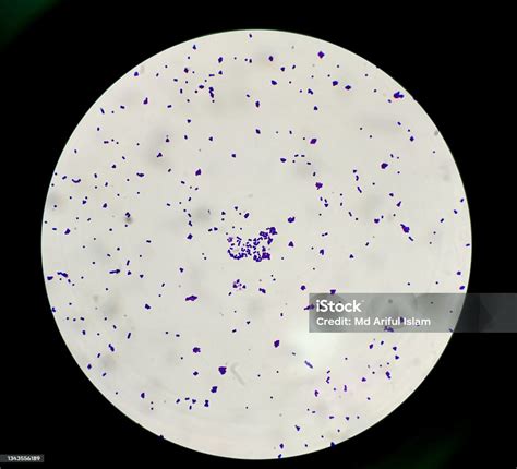 Staphylococcus Aureus Gram Stain 100x