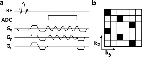 2 A Pulse Sequence Diagram Of A Spoiled 3d Gradient Echo With Download Scientific Diagram