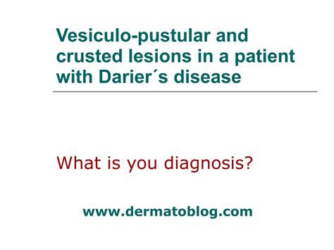 Vesiculo Pustular And Crusted Lesions In A Patient With Darier´s