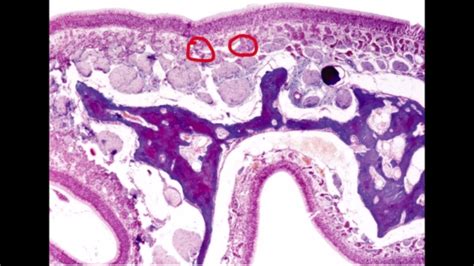 Respiratory Mucosa Nasal Mucosa Gross Microscopic