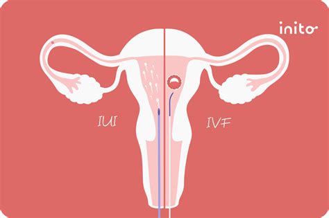 When To Have Sex After Lh Surge Your Complete Guide Inito