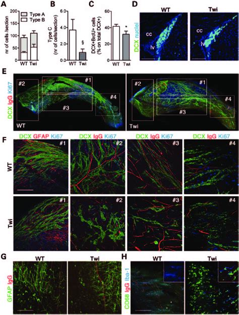 Impairment Of The Neuroblast Cell Population In The Lv SVZ Of Adult Twi