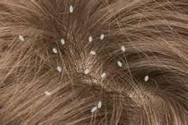 Itchy Scalp - Causes, Pictures, Remedies and Treatment