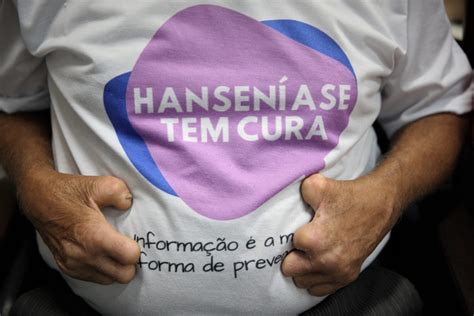 JANEIRO ROXO a luta do Acre contra a hanseníase Acre Agora