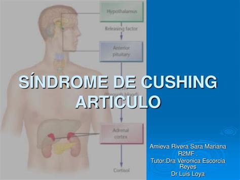 Sindrome De Cushing Sara Amieva UDocz