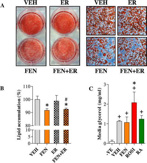 Fen Decreases Lipid Accumulation In Mature 3t3 L1 Adipocytes